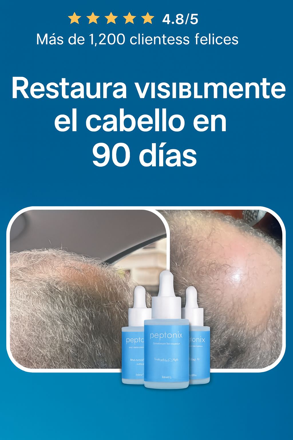 Suero para el crecimiento del cabello PEPTONIX